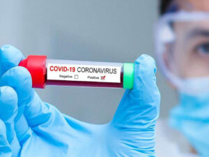 Još šest Prijedorčana pozitivno na korona virus: Novih 305 zaraženih u RS