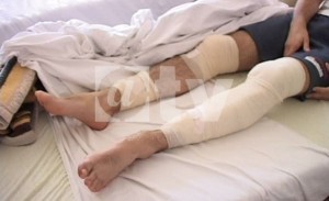 PUZIGAĆA PRETUČEN I IZBODEN JER NIJE IMAO CIGARETU – VIDEO